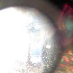 Peephole Sun Rainbow 2.14.18 #3